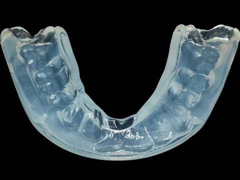 clear mouthguard custom from dentist